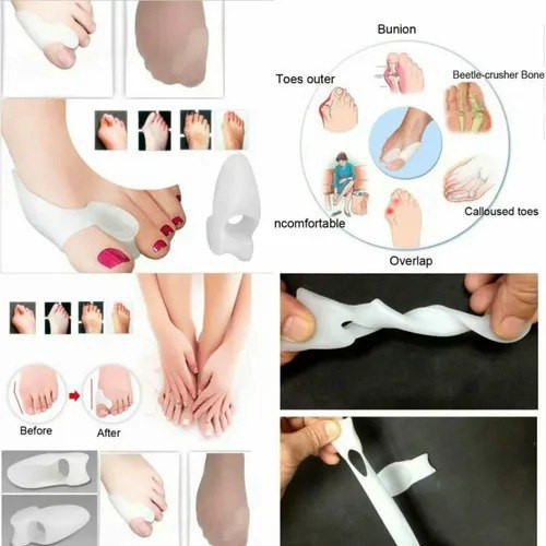 Miniatura 3 de JUANETERO SEPARADOR DE DEDOS